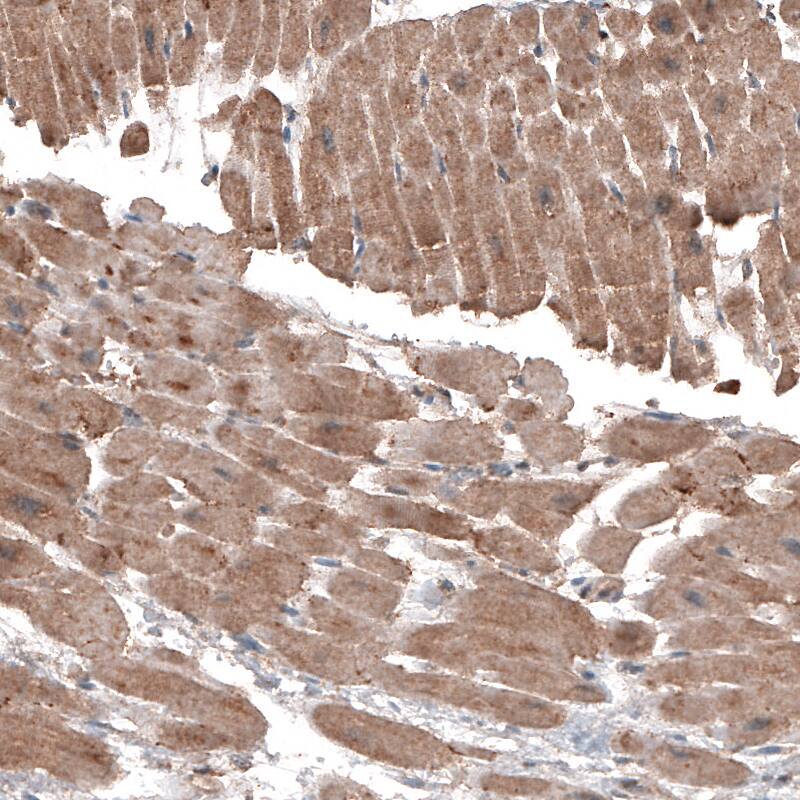 LAPTM4B Antibody (CL5287) - Azide and BSA Free Immunohistochemistry-Paraffin: LAPTM4B Antibody [NBP3-44245]