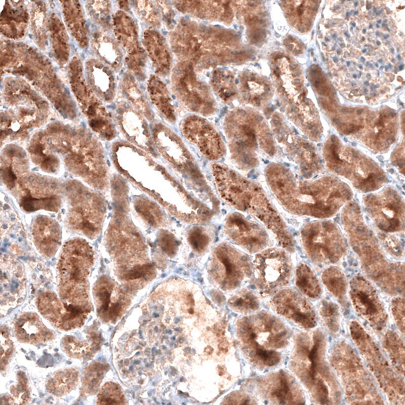 LAPTM4B Antibody (CL5287) - Azide and BSA Free Immunohistochemistry-Paraffin: LAPTM4B Antibody [NBP3-44245]