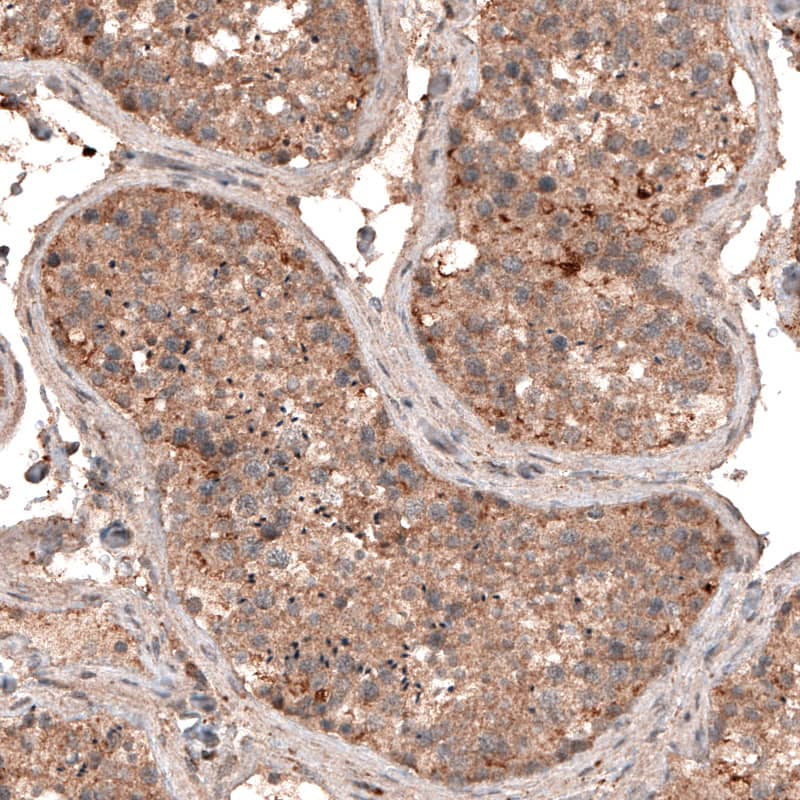 LAPTM4B Antibody (CL5287) - Azide and BSA Free Immunohistochemistry-Paraffin: LAPTM4B Antibody [NBP3-44245]