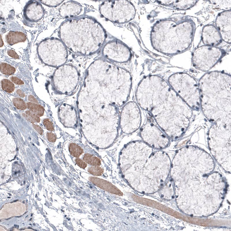 LAPTM4B Antibody (CL5287) - Azide and BSA Free Immunohistochemistry-Paraffin: LAPTM4B Antibody [NBP3-44245]