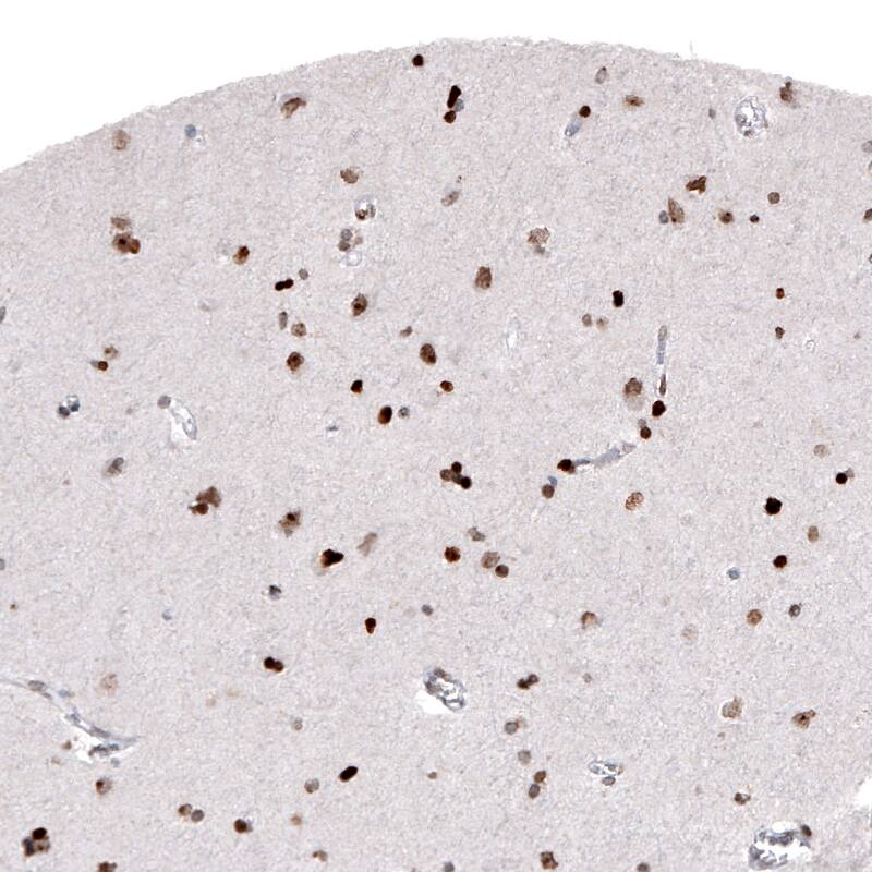 Macro H2A.2 Antibody (CL5263) - Azide and BSA Free Immunohistochemistry-Paraffin: Macro H2A.2 Antibody [NBP3-44246]