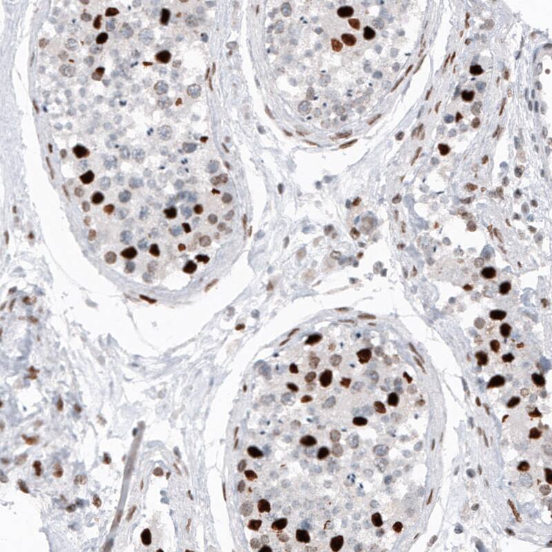 Macro H2A.2 Antibody (CL5263) - Azide and BSA Free Immunohistochemistry-Paraffin: Macro H2A.2 Antibody [NBP3-44246]