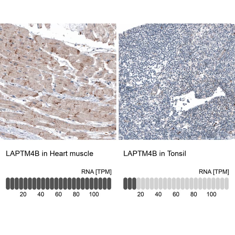 LAPTM4B Antibody (CL5289) - Azide and BSA Free Immunohistochemistry-Paraffin: LAPTM4B Antibody [NBP3-44247]