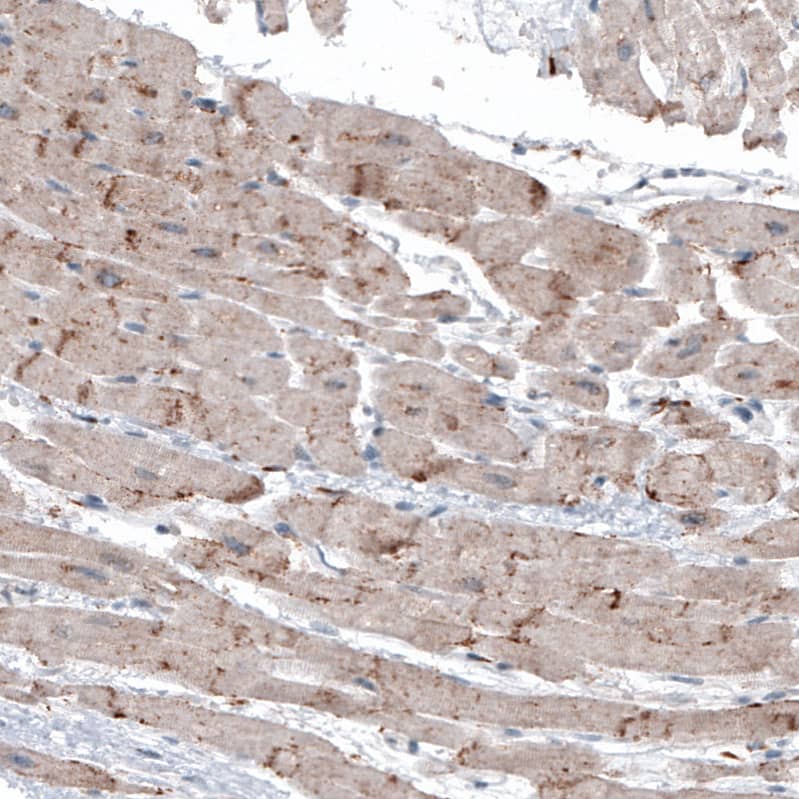 LAPTM4B Antibody (CL5289) - Azide and BSA Free Immunohistochemistry-Paraffin: LAPTM4B Antibody [NBP3-44247]