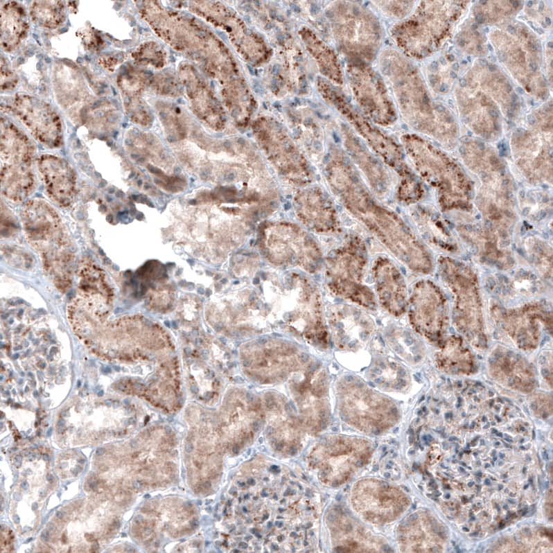 LAPTM4B Antibody (CL5289) - Azide and BSA Free Immunohistochemistry-Paraffin: LAPTM4B Antibody [NBP3-44247]