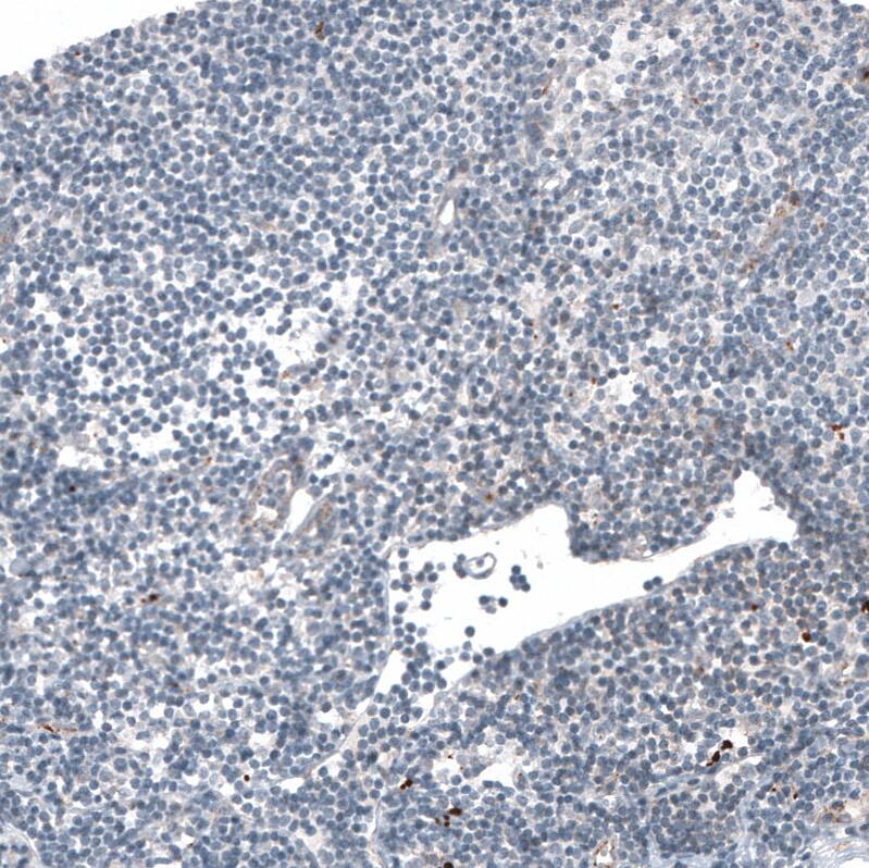 LAPTM4B Antibody (CL5289) - Azide and BSA Free Immunohistochemistry-Paraffin: LAPTM4B Antibody [NBP3-44247]
