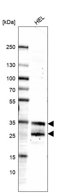 LAPTM4B Antibody (CL5289) - Azide and BSA Free Western Blot: LAPTM4B Antibody [NBP3-44247]