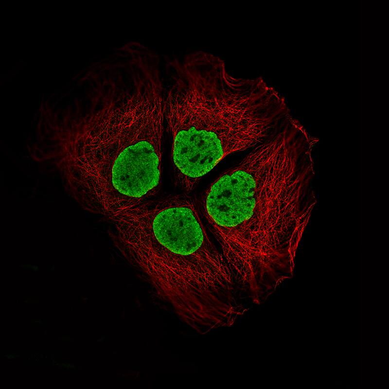 Histone H2AY/macroH2A.1 Antibody (CL5245) - Azide and BSA Free Immunocytochemistry/ Immunofluorescence: Histone H2AY/macroH2A.1 Antibody [NBP3-44248]