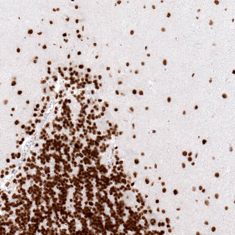 Histone H2AY/macroH2A.1 Antibody (CL5245) - Azide and BSA Free Immunohistochemistry-Paraffin: Histone H2AY/macroH2A.1 Antibody [NBP3-44248]