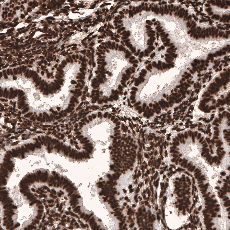 HIST1H3A Antibody (CL4967) - Azide and BSA Free Immunohistochemistry-Paraffin: HIST1H3A Antibody [NBP3-44249]