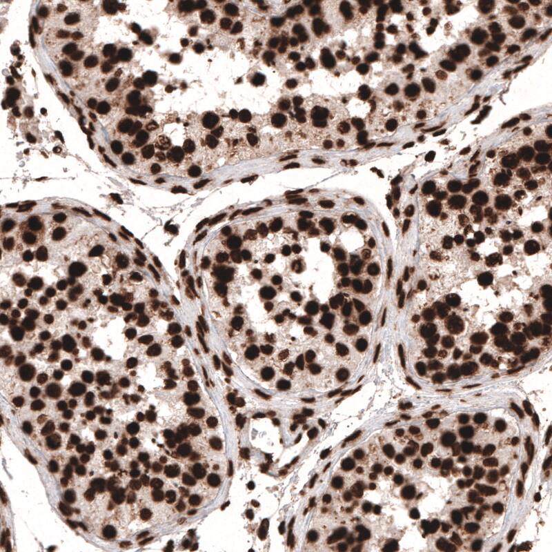 HIST1H3A Antibody (CL4967) - Azide and BSA Free Immunohistochemistry-Paraffin: HIST1H3A Antibody [NBP3-44249]