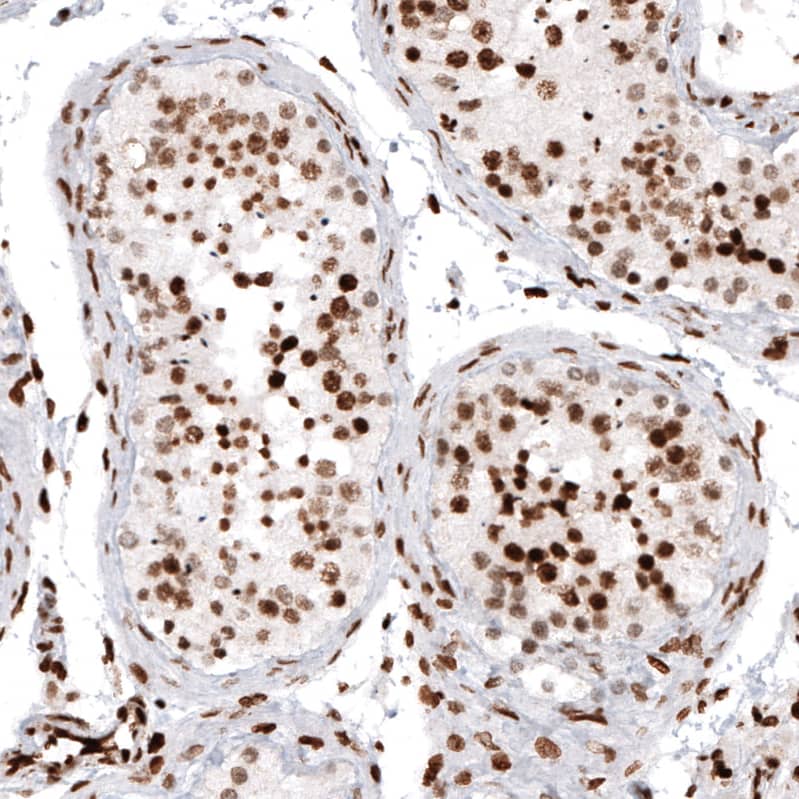 HIST1H2AG Antibody (CL5039) - Azide and BSA Free Immunohistochemistry-Paraffin: HIST1H2AG Antibody [NBP3-44251]