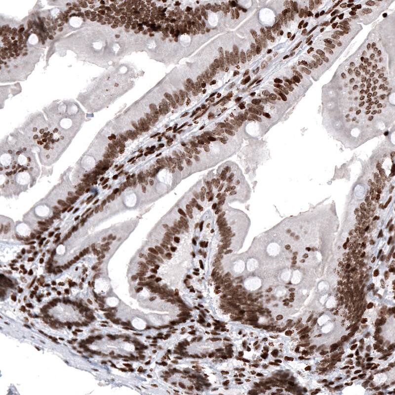 HIST1H2AG Antibody (CL5041) - Azide and BSA Free Immunohistochemistry-Paraffin: HIST1H2AG Antibody [NBP3-44252]