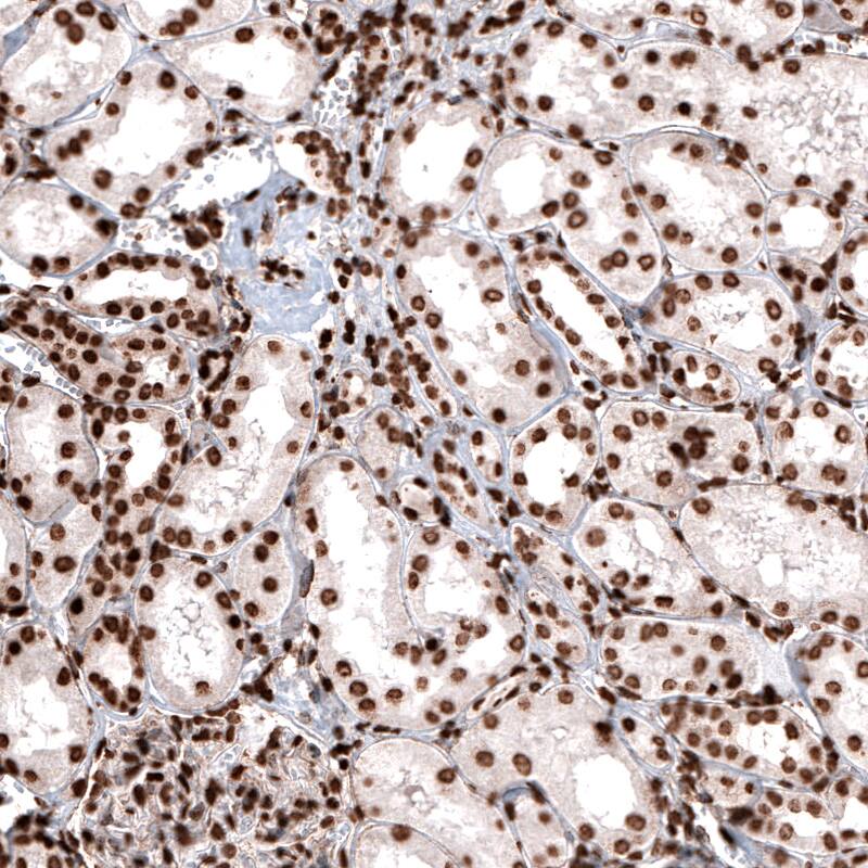 HIST1H2BC Antibody (CL5048) - Azide and BSA Free Immunohistochemistry-Paraffin: HIST1H2BC Antibody [NBP3-44253]