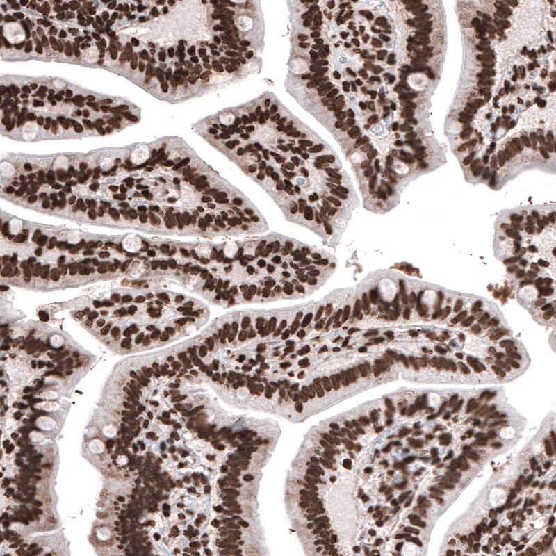 HIST1H2BC Antibody (CL5048) - Azide and BSA Free Immunohistochemistry-Paraffin: HIST1H2BC Antibody [NBP3-44253]