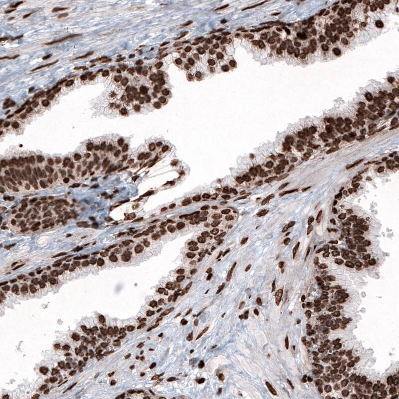 HIST1H2BC Antibody (CL5048) - Azide and BSA Free Immunohistochemistry-Paraffin: HIST1H2BC Antibody [NBP3-44253]