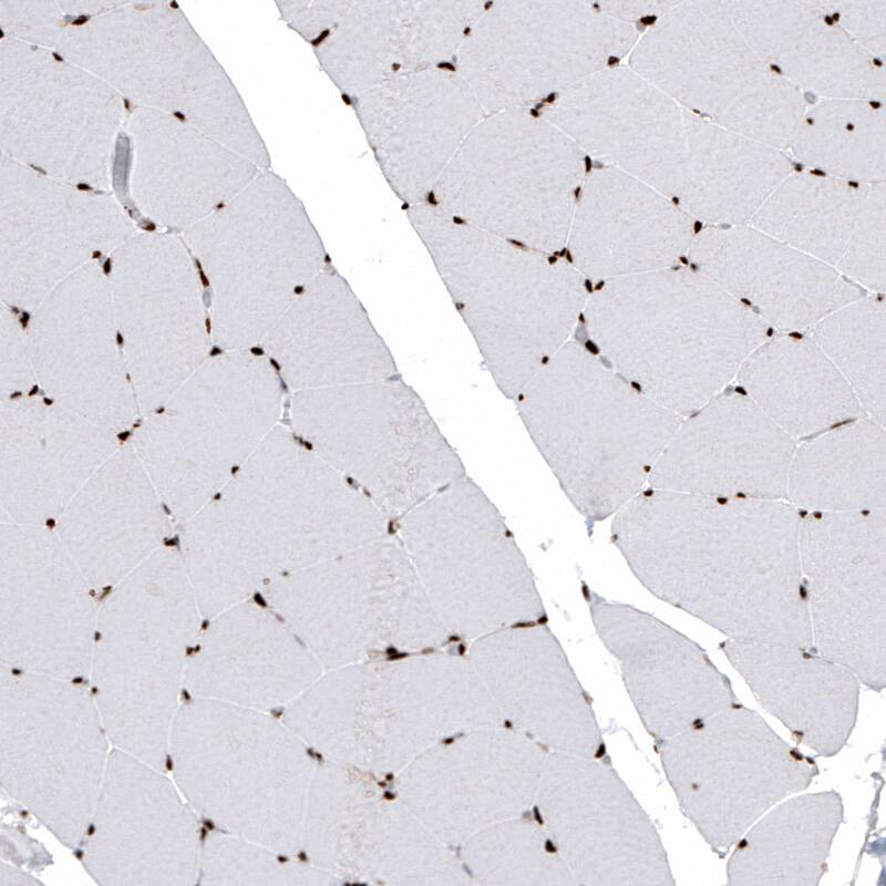 HIST1H2BC Antibody (CL5101) - Azide and BSA Free Immunohistochemistry-Paraffin: HIST1H2BC Antibody [NBP3-44254]