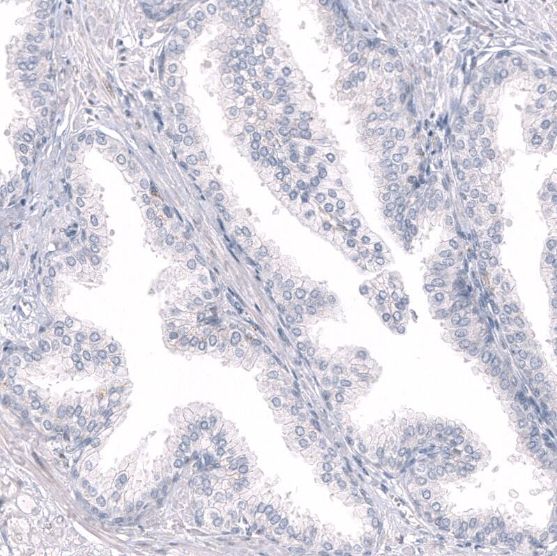 RBFOX3/NeuN Antibody (CL11896) - Azide and BSA Free Immunohistochemistry-Paraffin: RBFOX3/NeuN Antibody [NBP3-44255]