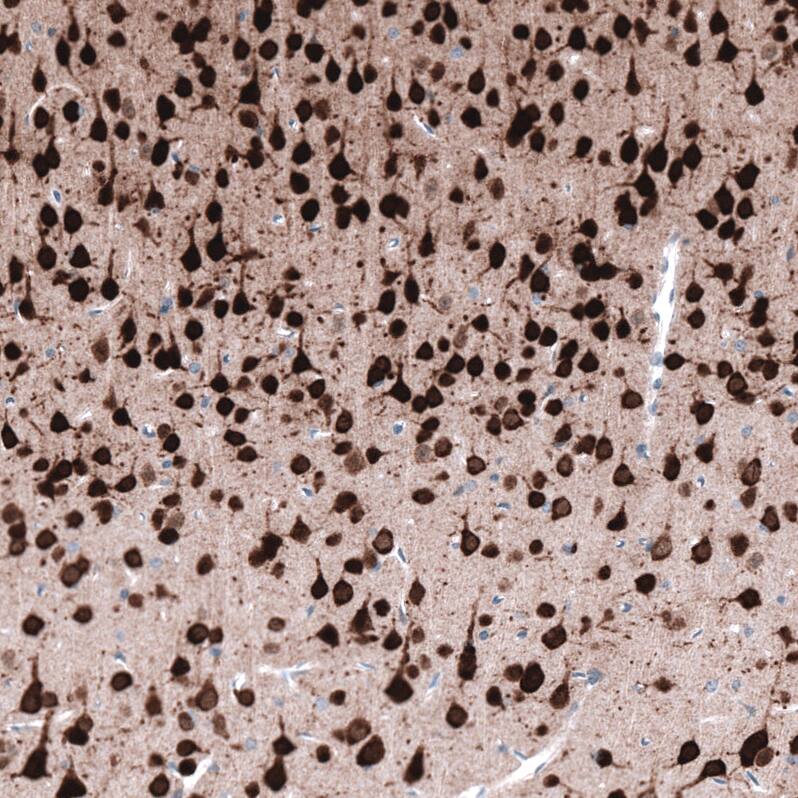 RBFOX3/NeuN Antibody (CL11896) - Azide and BSA Free Immunohistochemistry-Paraffin: RBFOX3/NeuN Antibody [NBP3-44255]