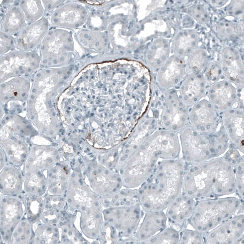 CD133 Antibody (CL7971) - Azide and BSA Free Immunohistochemistry-Paraffin: CD133 Antibody [NBP3-44257]