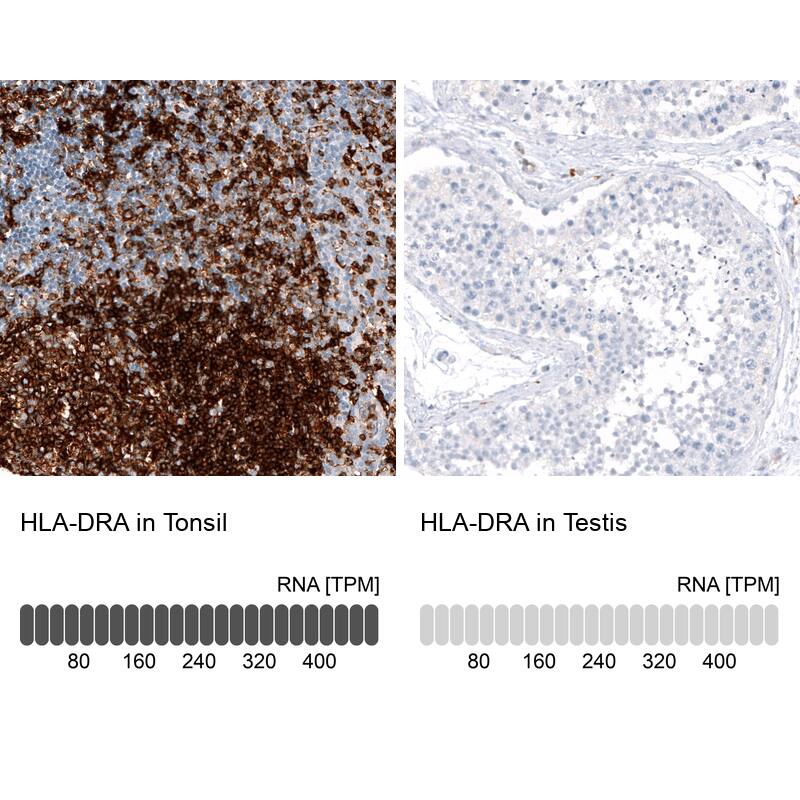HLA DR/DP Antibody (CL10961) - Azide and BSA Free Immunohistochemistry-Paraffin: HLA DR/DP Antibody [NBP3-44260]