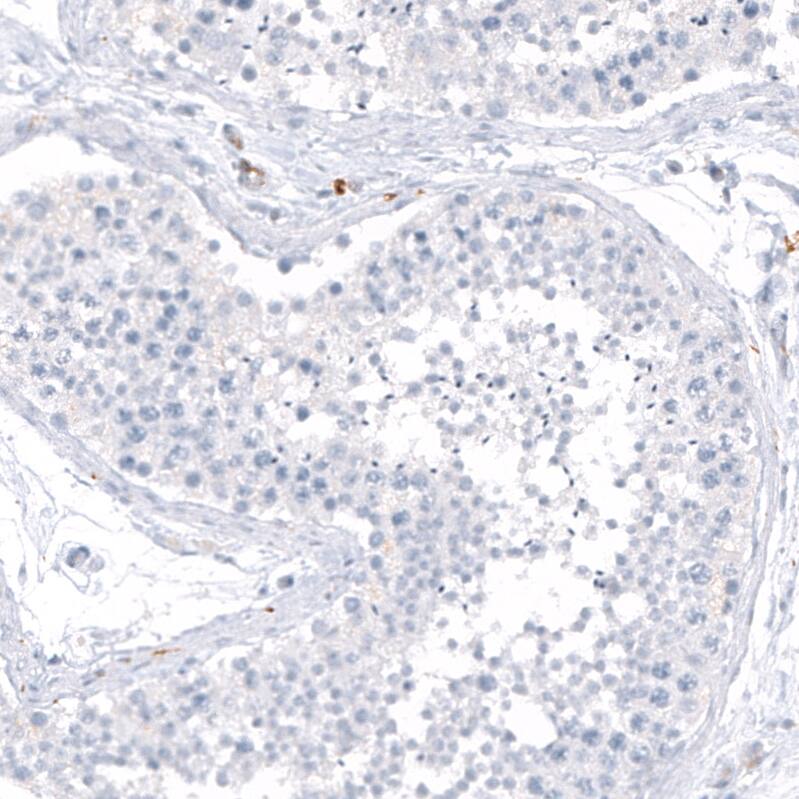 HLA DR/DP Antibody (CL10961) - Azide and BSA Free Immunohistochemistry-Paraffin: HLA DR/DP Antibody [NBP3-44260]