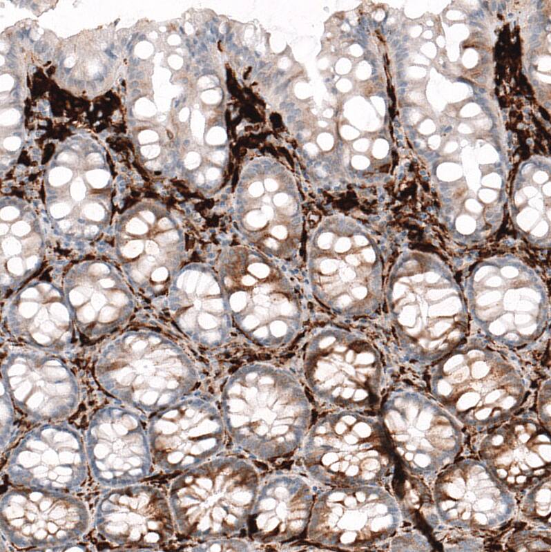 HLA DR/DP Antibody (CL10962) - Azide and BSA Free Immunohistochemistry-Paraffin: HLA DR/DP Antibody [NBP3-44261]