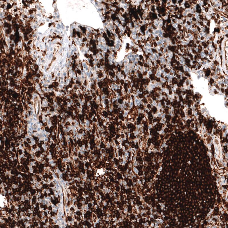 HLA DR/DP Antibody (CL10962) - Azide and BSA Free Immunohistochemistry-Paraffin: HLA DR/DP Antibody [NBP3-44261]