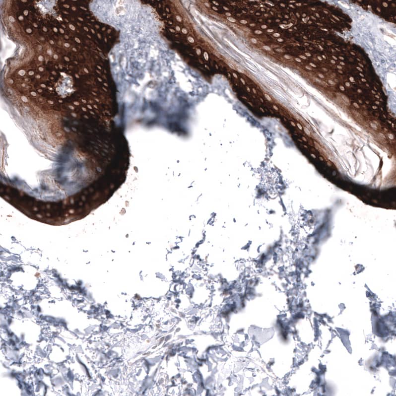 Cytokeratin 14 Antibody (CL14565) - Azide and BSA Free Immunohistochemistry-Paraffin: Cytokeratin 14 Antibody [NBP3-44263]