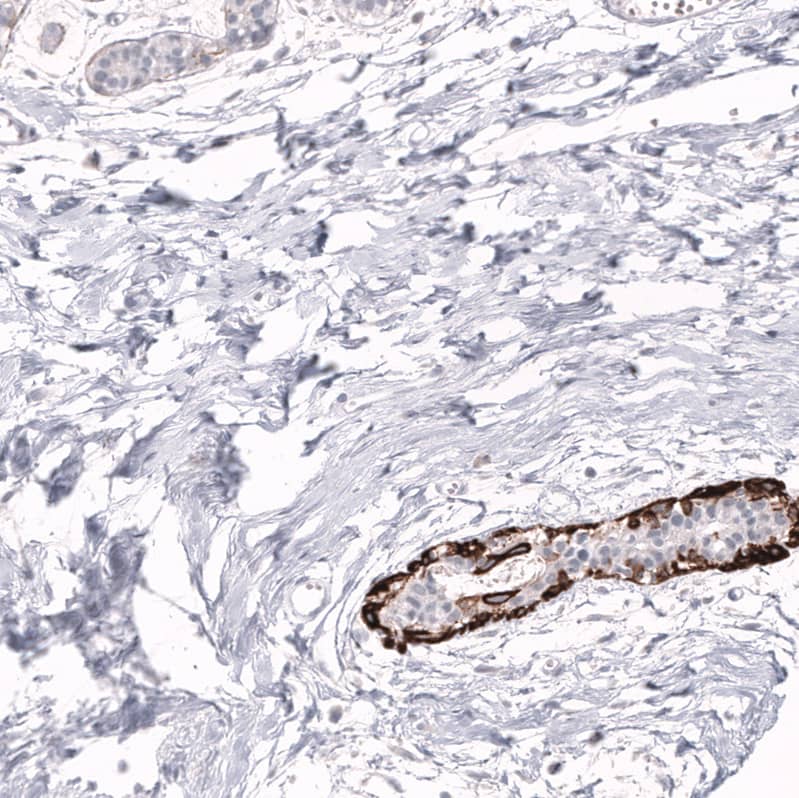 Cytokeratin 14 Antibody (CL14568) - Azide and BSA Free Immunohistochemistry-Paraffin: Cytokeratin 14 Antibody [NBP3-44264]