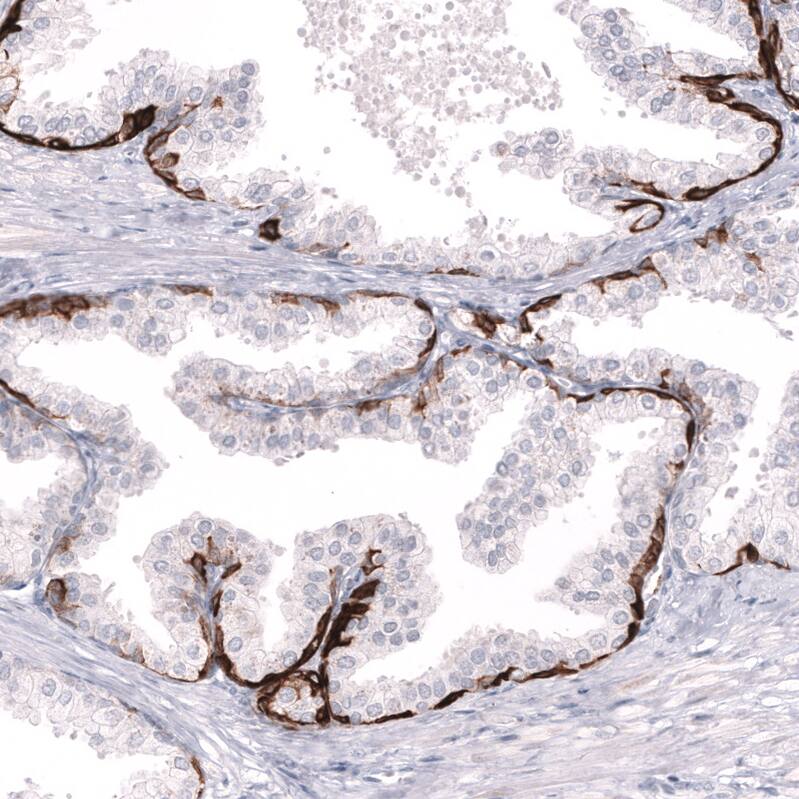 Cytokeratin 14 Antibody (CL14568) - Azide and BSA Free Immunohistochemistry-Paraffin: Cytokeratin 14 Antibody [NBP3-44264]