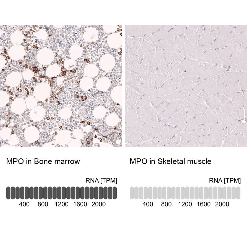 Myeloperoxidase/MPO Antibody (CL14976) - Azide and BSA Free Immunohistochemistry-Paraffin: Myeloperoxidase/MPO Antibody [NBP3-44265]