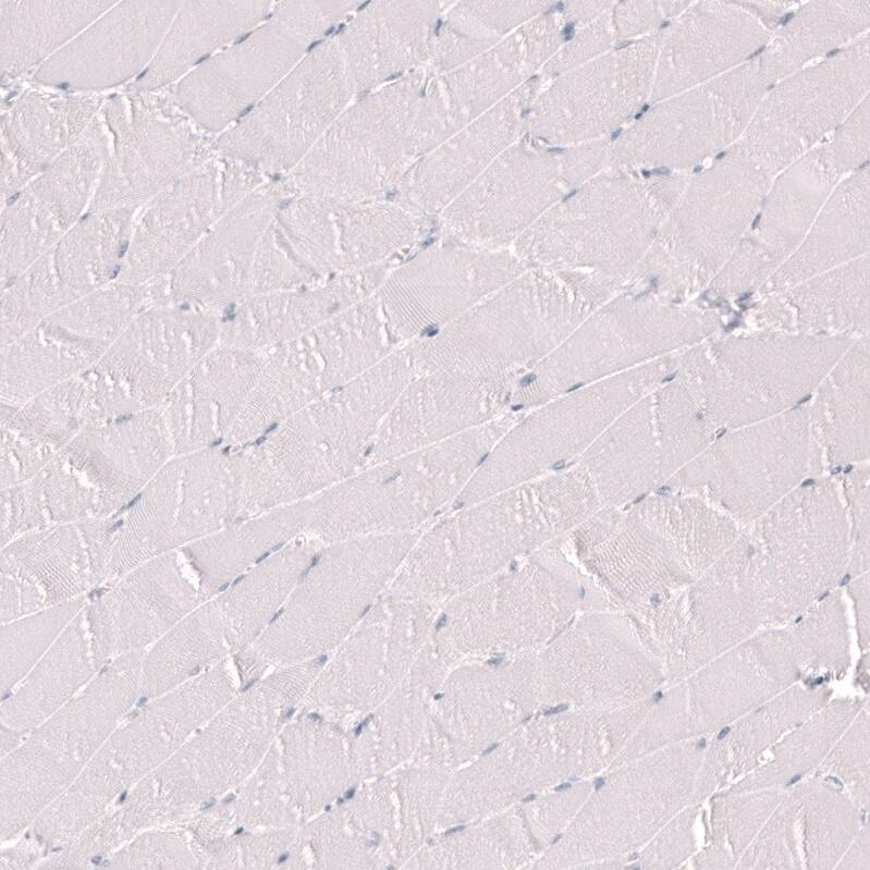 Myeloperoxidase/MPO Antibody (CL14976) - Azide and BSA Free Immunohistochemistry-Paraffin: Myeloperoxidase/MPO Antibody [NBP3-44265]