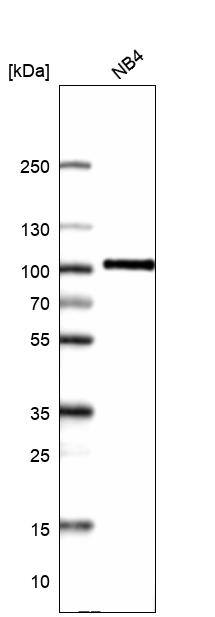 Myeloperoxidase/MPO Antibody (CL14976) - Azide and BSA Free Western Blot: Myeloperoxidase/MPO Antibody [NBP3-44265]