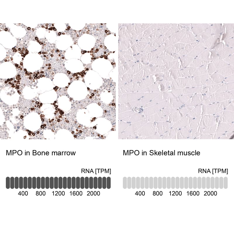 Myeloperoxidase/MPO Antibody (CL15002) - Azide and BSA Free Immunohistochemistry-Paraffin: Myeloperoxidase/MPO Antibody [NBP3-44267]