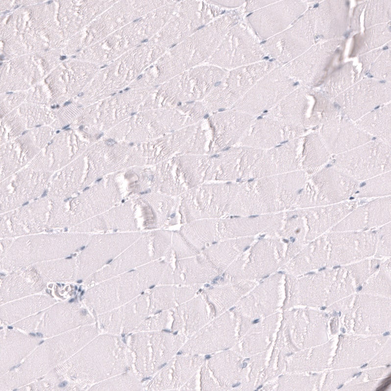 Myeloperoxidase/MPO Antibody (CL15002) - Azide and BSA Free Immunohistochemistry-Paraffin: Myeloperoxidase/MPO Antibody [NBP3-44267]
