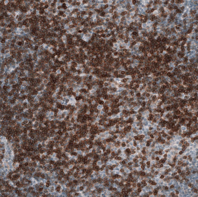 CD5 Antibody (CL12420) - Azide and BSA Free Immunohistochemistry-Paraffin: CD5 Antibody [NBP3-44269]