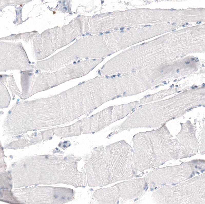 CD5 Antibody (CL12420) - Azide and BSA Free Immunohistochemistry-Paraffin: CD5 Antibody [NBP3-44269]
