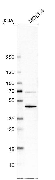 CD5 Antibody (CL12420) - Azide and BSA Free Western Blot: CD5 Antibody [NBP3-44269]
