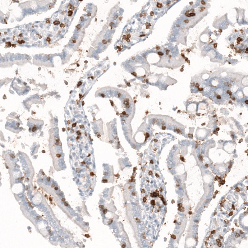 CD5 Antibody (CL12420) - Azide and BSA Free Immunohistochemistry-Paraffin: CD5 Antibody [NBP3-44269]