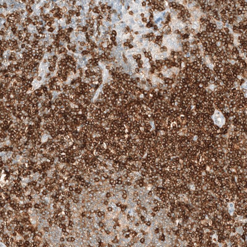 CD5 Antibody (CL12420) - Azide and BSA Free Immunohistochemistry-Paraffin: CD5 Antibody [NBP3-44269]