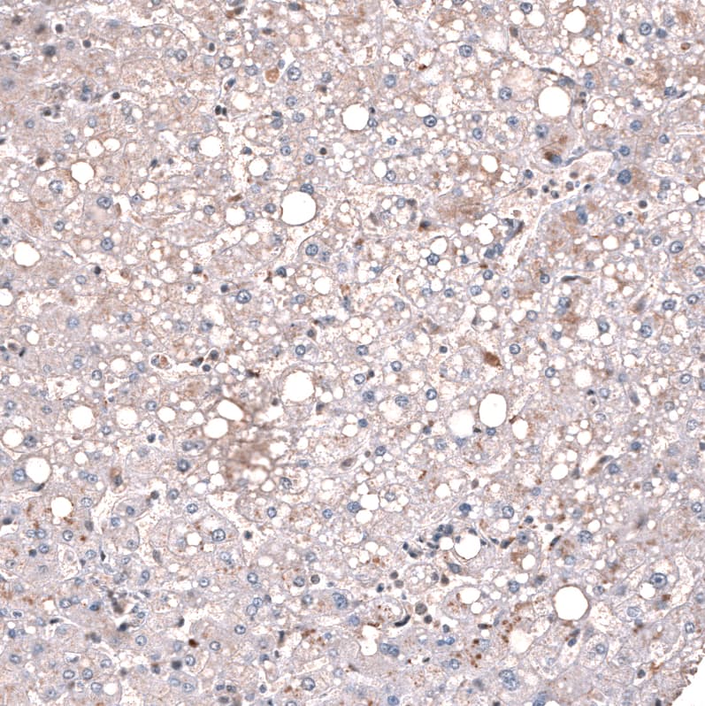 GLI-1 Antibody (CL12192) - Azide and BSA Free Immunohistochemistry-Paraffin: GLI-1 Antibody [NBP3-44271]