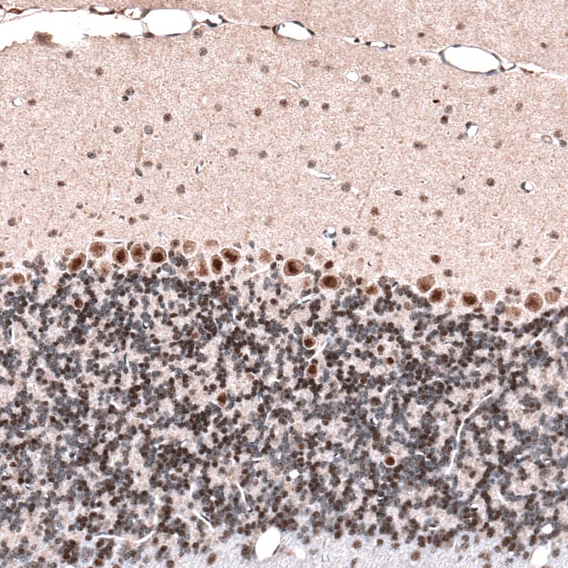GLI-1 Antibody (CL12192) - Azide and BSA Free Immunohistochemistry-Paraffin: GLI-1 Antibody [NBP3-44271]