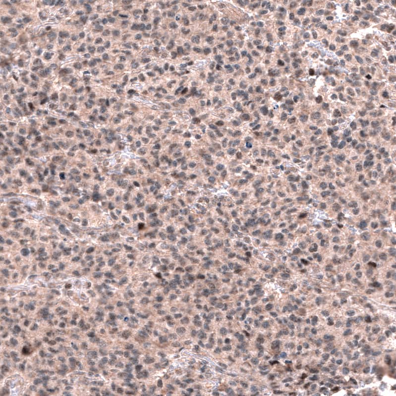 GLI-1 Antibody (CL12192) - Azide and BSA Free Immunohistochemistry-Paraffin: GLI-1 Antibody [NBP3-44271]