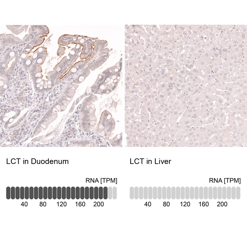 Lactase Antibody (CL14122) - Azide and BSA Free Immunohistochemistry-Paraffin: Lactase Antibody [NBP3-44272]