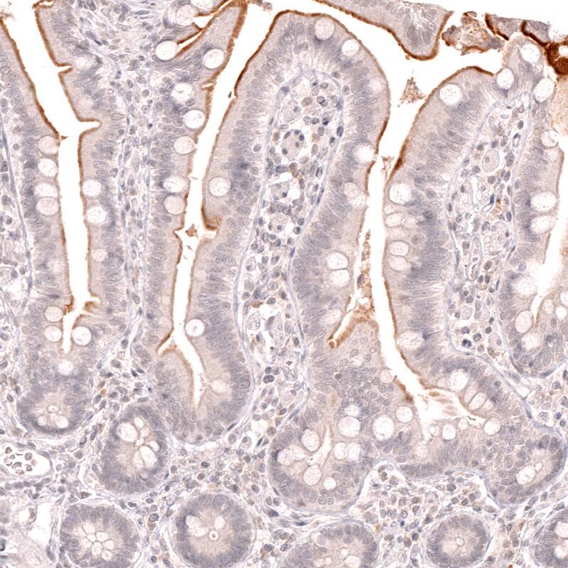 Lactase Antibody (CL14122) - Azide and BSA Free Immunohistochemistry-Paraffin: Lactase Antibody [NBP3-44272]