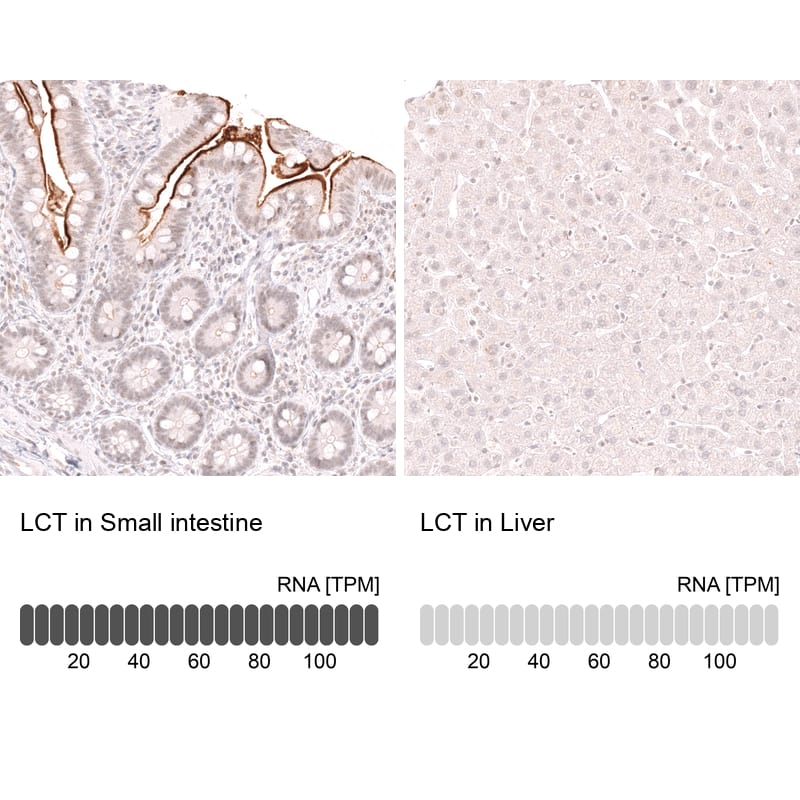 Lactase Antibody (CL14133) - Azide and BSA Free Immunohistochemistry-Paraffin: Lactase Antibody [NBP3-44273]