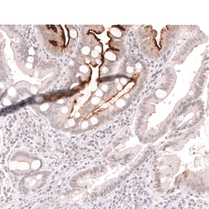 Lactase Antibody (CL14133) - Azide and BSA Free Immunohistochemistry-Paraffin: Lactase Antibody [NBP3-44273]