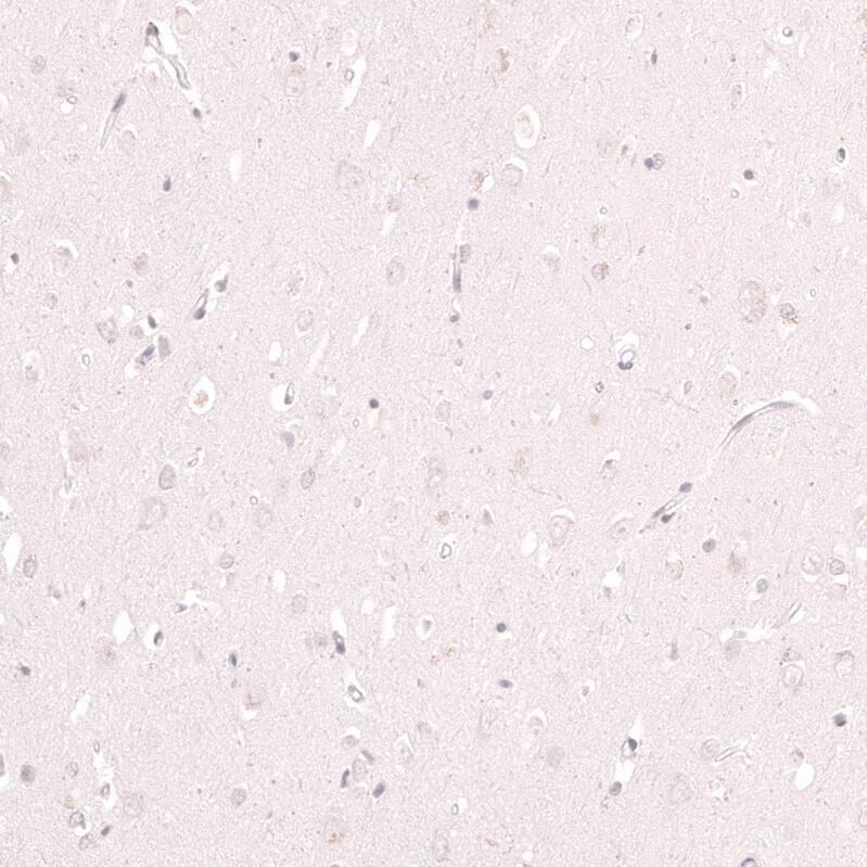 Lactase Antibody (CL14133) - Azide and BSA Free Immunohistochemistry-Paraffin: Lactase Antibody [NBP3-44273]
