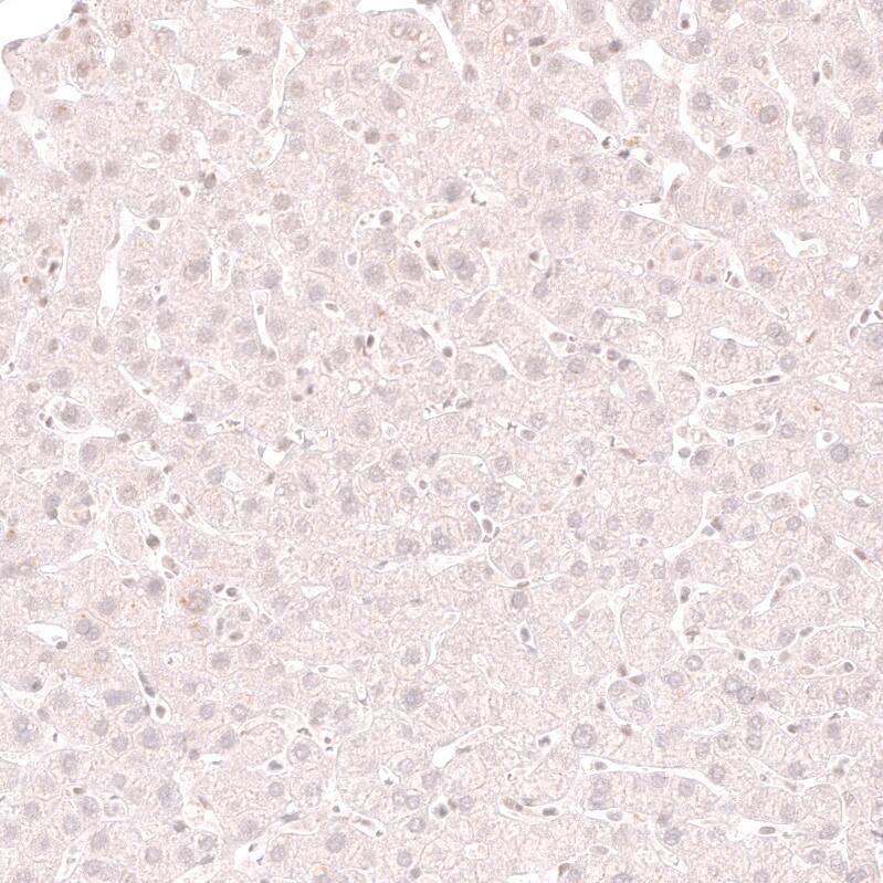 Lactase Antibody (CL14133) - Azide and BSA Free Immunohistochemistry-Paraffin: Lactase Antibody [NBP3-44273]